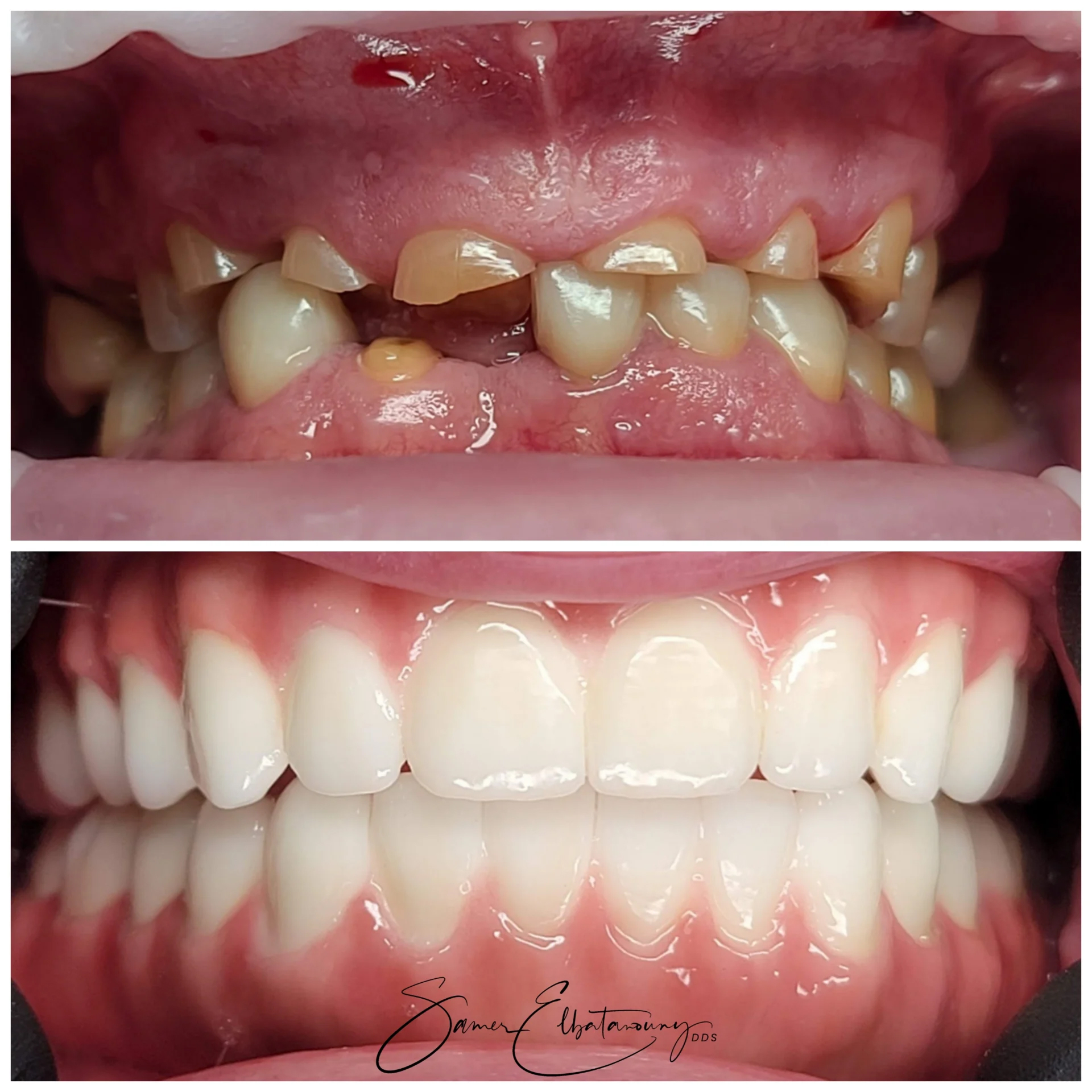 befor-after image