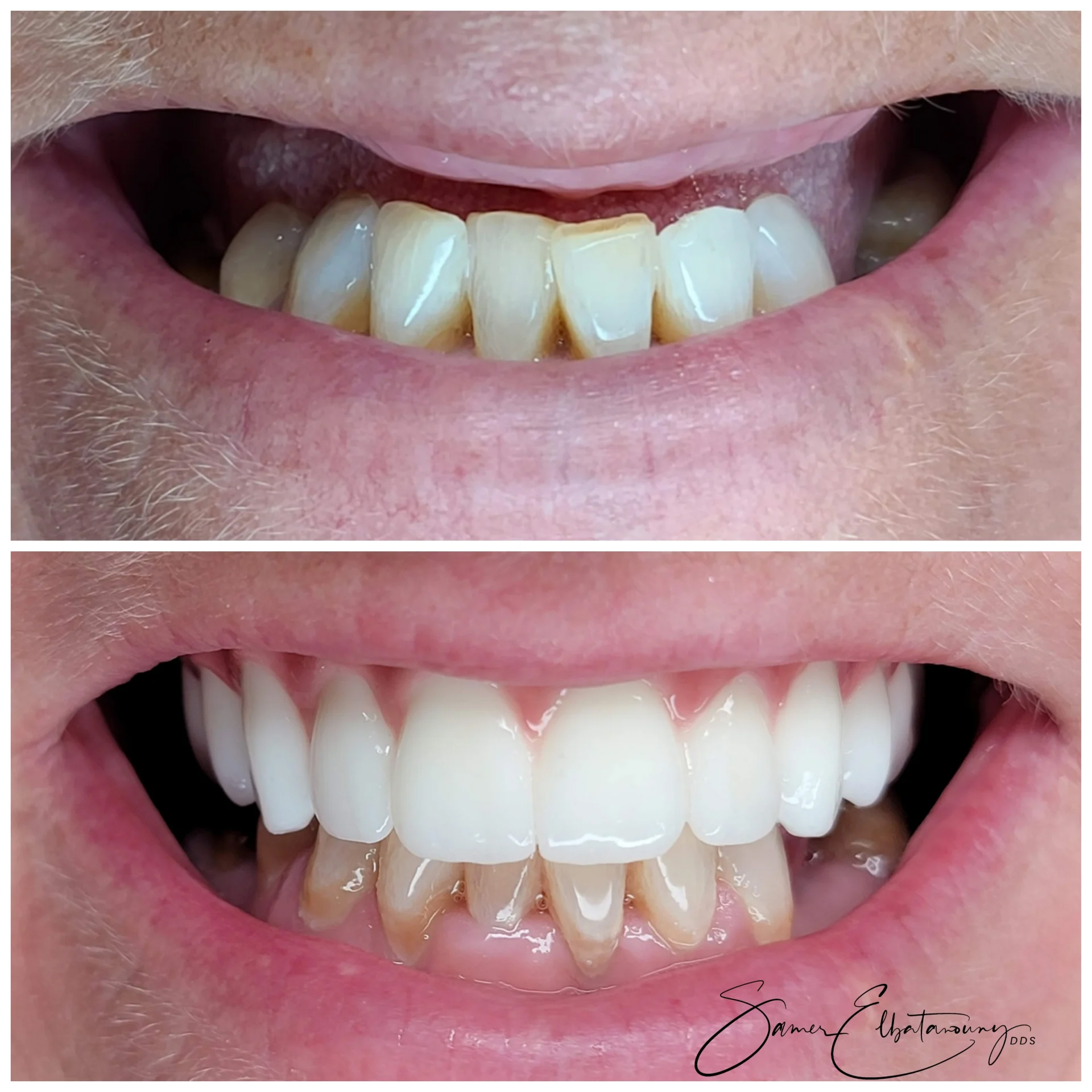 befor-after image