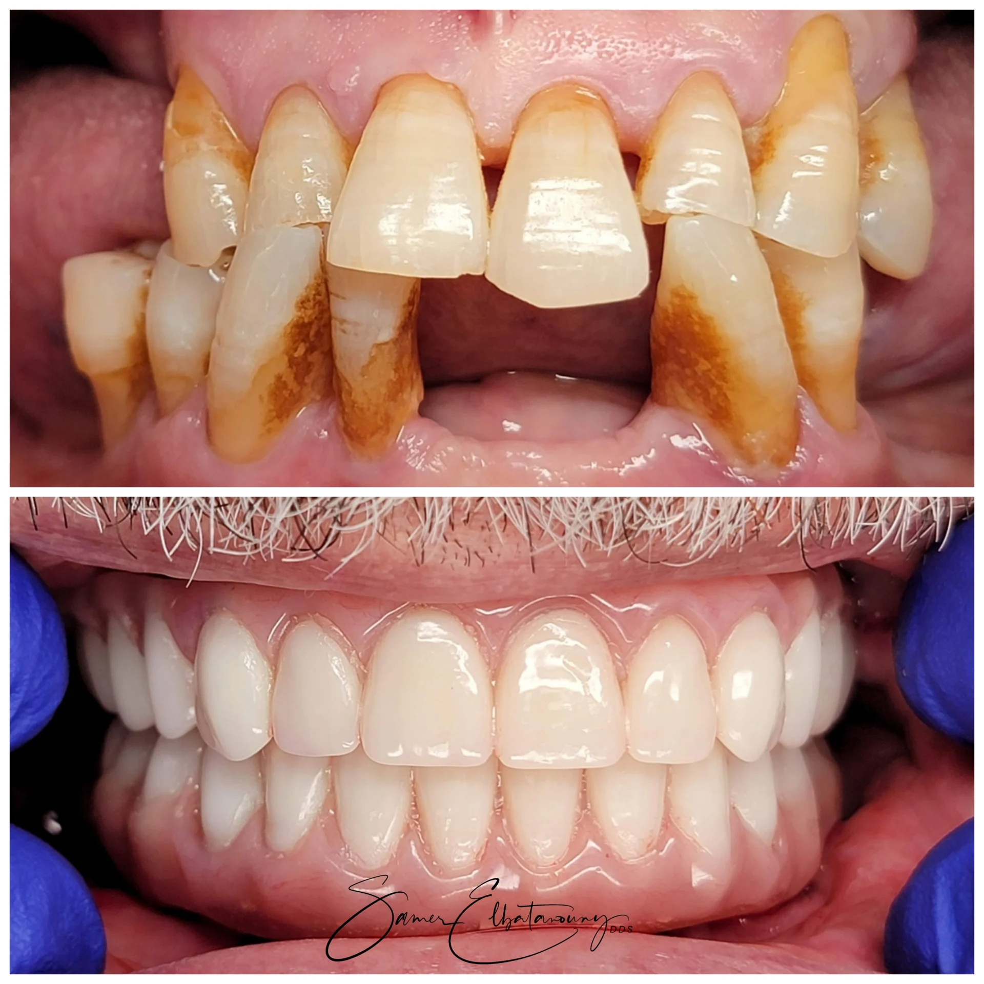 befor-after image
