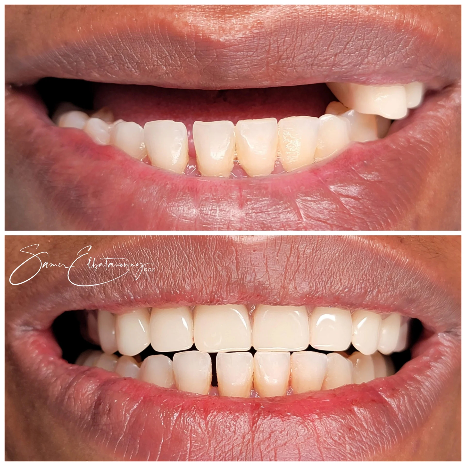 befor-after image