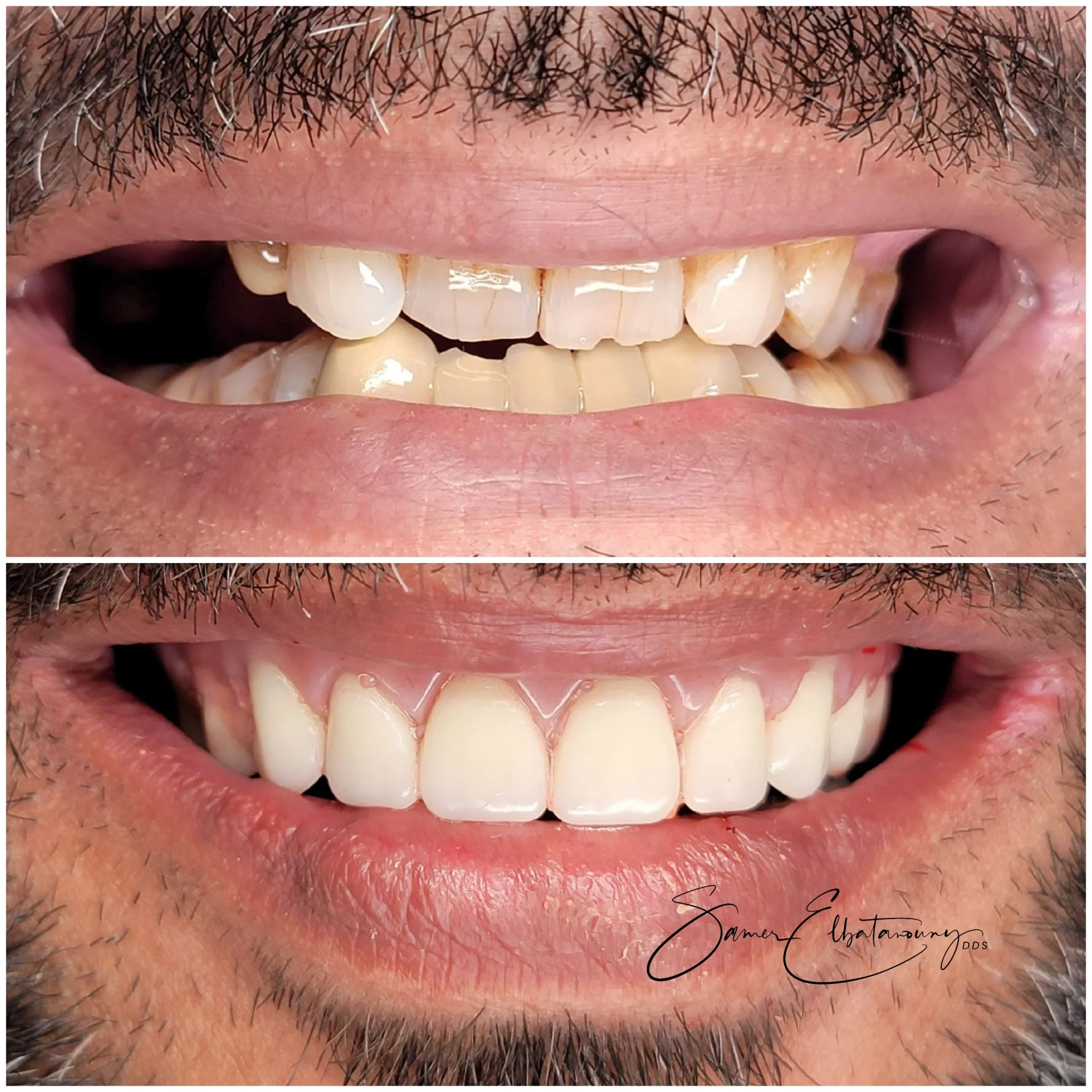 befor-after image