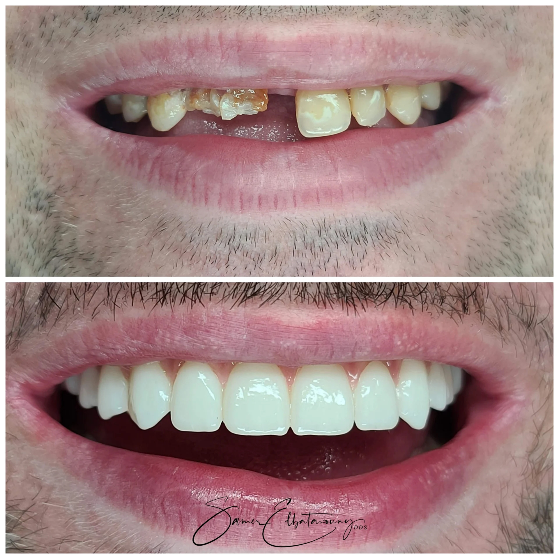 befor-after image
